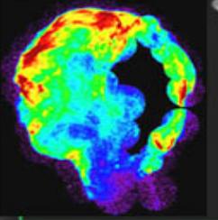 X-ray Image of Supernova Remnant 